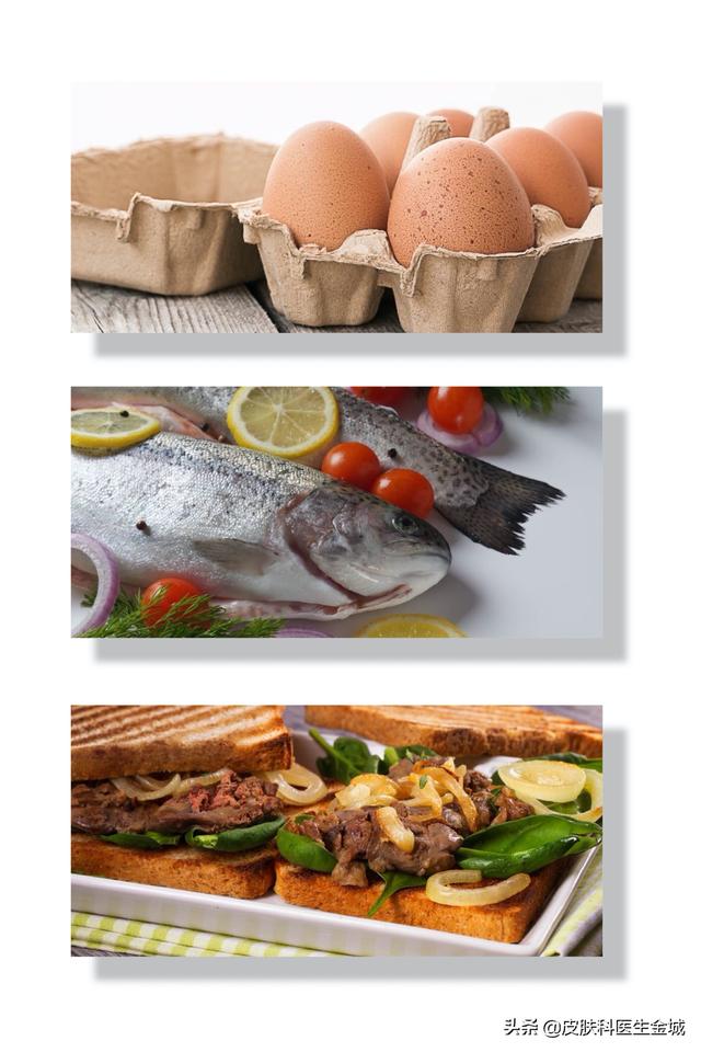 宜宾痤疮（哪些食物痤疮患者可以尽情享用？）