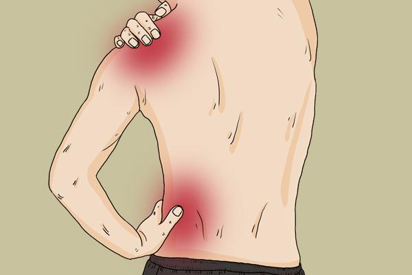 鸽子肝脏不好症状（肝脏不好症状是什么）