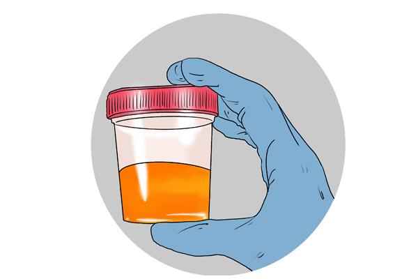 鸽子肝脏不好症状（肝脏不好症状是什么）